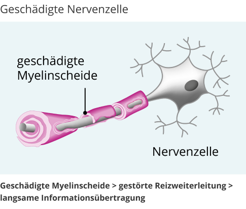 kaputte nervenzelle