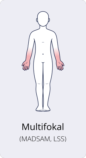 Multifokal (MADSAM, LSS)